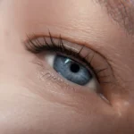 Межресничка