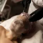 чистка